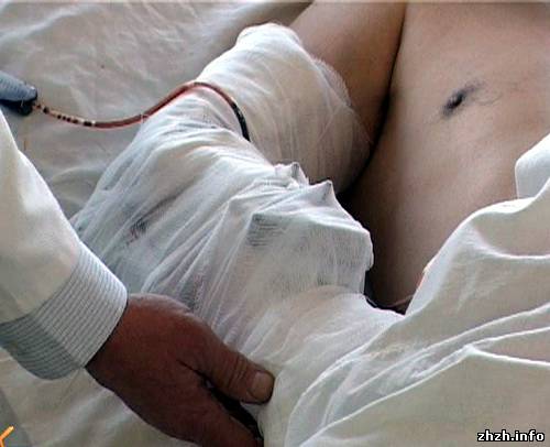 Бердичевские и житомирские доктора провели уникальную операцию на руке. ФОТО